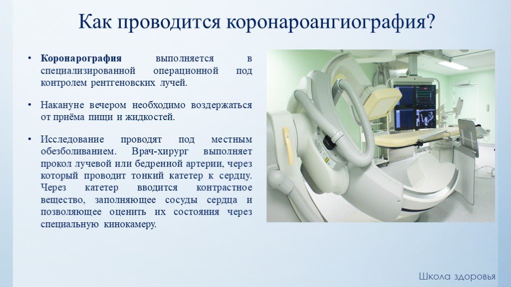 Как делают коронографию. Коронарография проведение. Коронарография как проводится. Коронарография подготовка пациента. Коронарография сосудов сердца подготовка пациента.