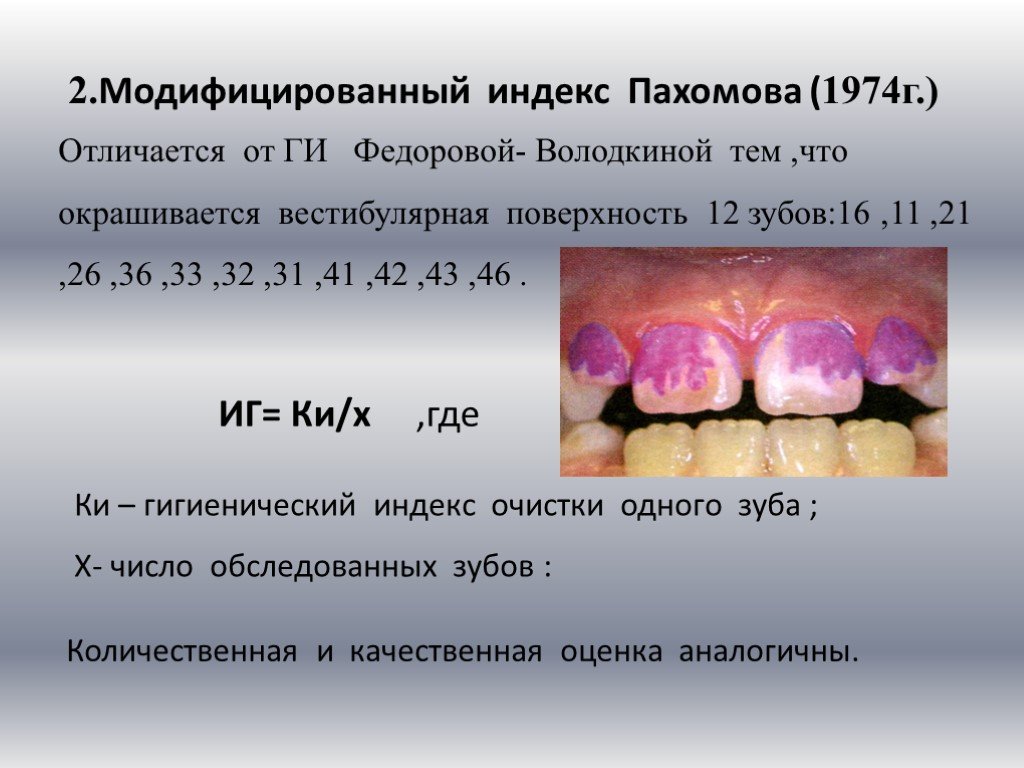 Индексы состояния полости рта. Индекс гигиены. Индексы в стоматологии. Индекс гигиены в стоматологии.