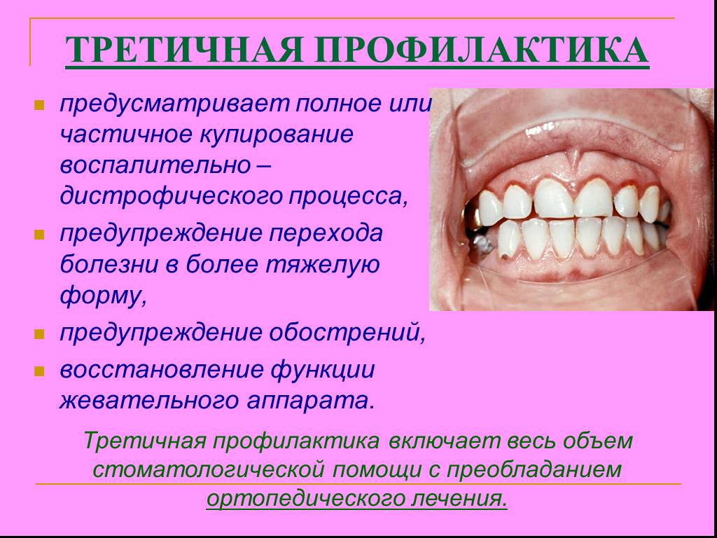 Полость рта профилактика лечение. Третичная профилактика в стоматологии. Третичная профилактика заболеваний пародонта. Третичная профилактика стоматологических заболеваний. Первичная профилактика пародонтита.