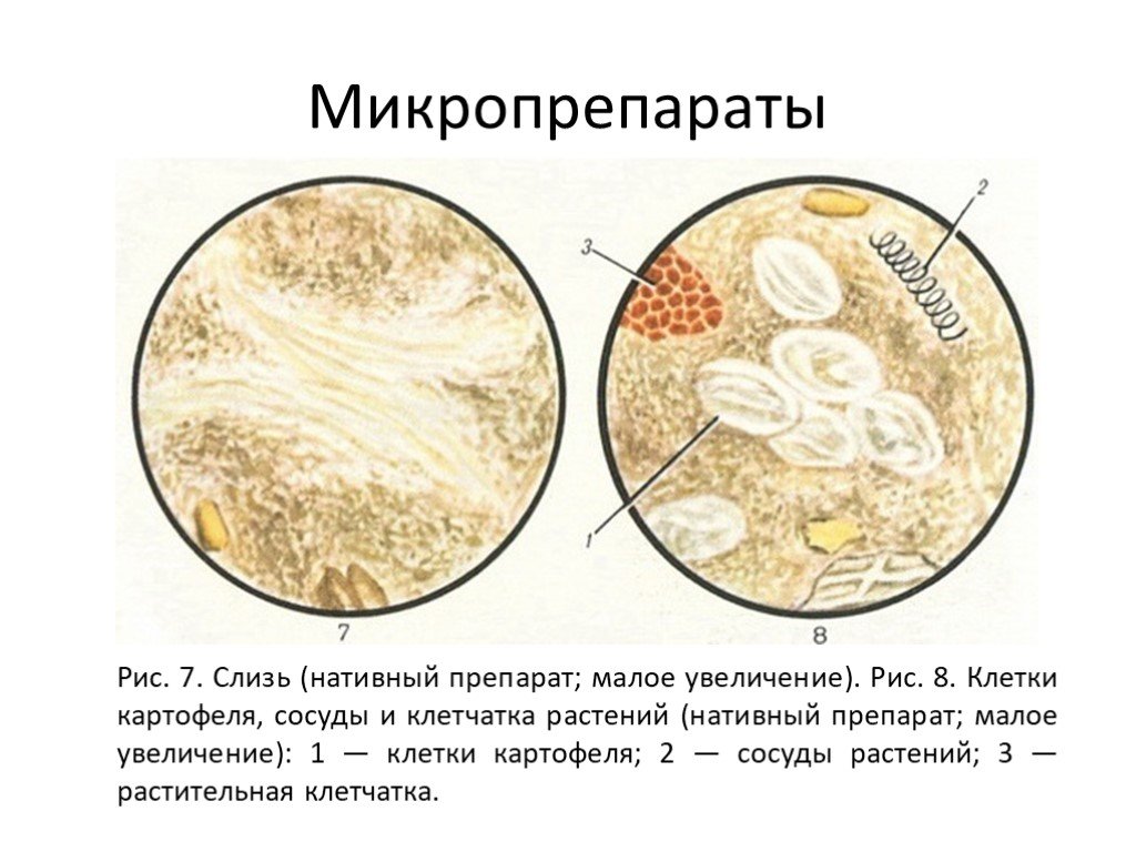 Растительная клетчатка непереваримая. Микроскопия кала растительная клетчатка переваримая. Растительная клетчатка в Кале микроскопия. Микроскопия нативного препарата кала. Микроскопия кала соединительная ткань.