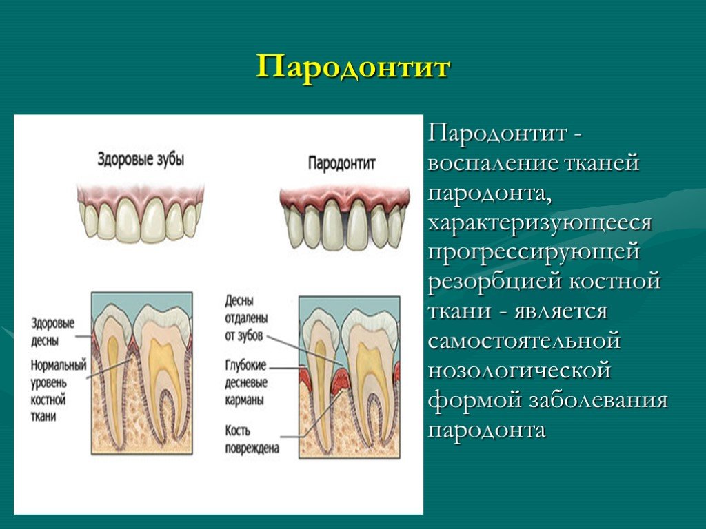 Где находится десна