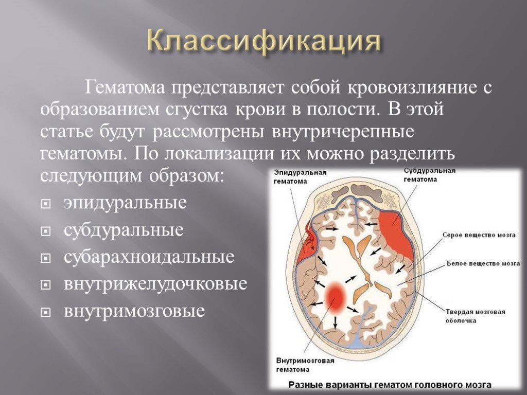 Кровоизлияния головного мозга последствия