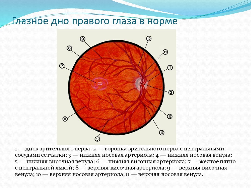 Нормальное глазное. Офтальмоскопия глазного дна норма. Глазное дно диск зрительного нерва норма. Диск зрительного нерва топография. Анатомия сосудов глазного дна.