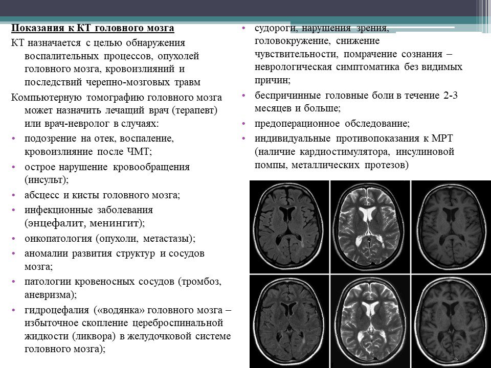 Диагнозы опухоли мозга. Кт при абсцессе головного мозга. Абсцесс головного мозга кт. Показания к кт мозга. Показания к кт головного мозга.