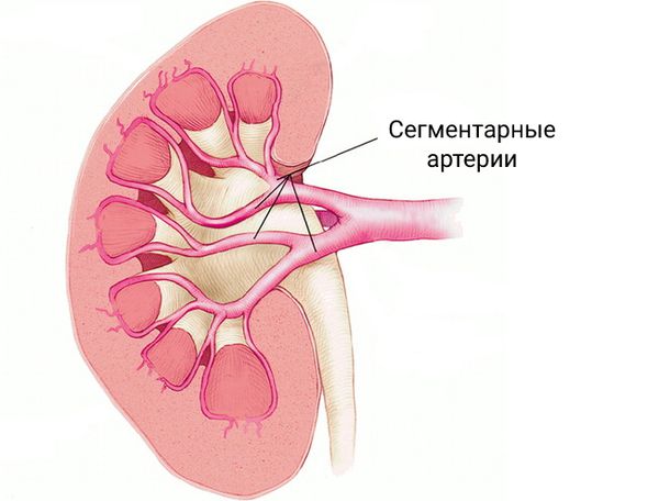 Паренхиматозная киста почки. Таблетки от кисты почек. Почечная артерия Устье, сегментарная. Круг заместительной почечной. Киста на почке в области артерии.