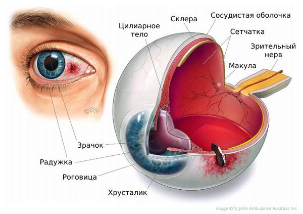 Инородное тело глаза карта смп - 97 фото