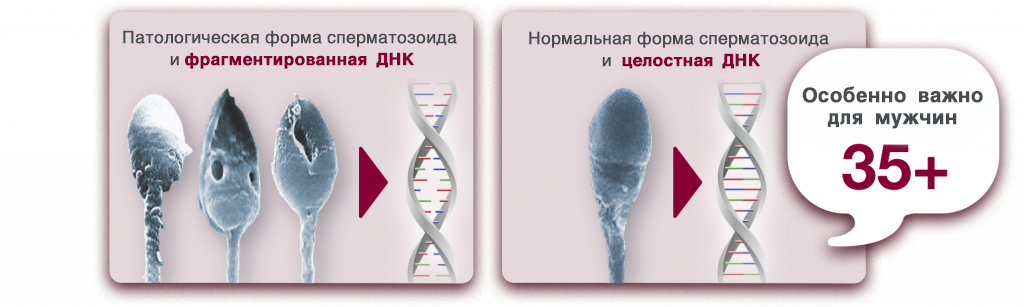 Девушка с мужской стрижкой закусила мужской спермой после секса