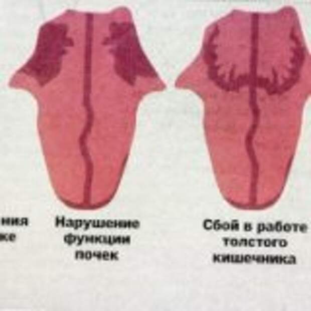 Налет на языке о чем говорит таблица цветов с названиями и описанием фото