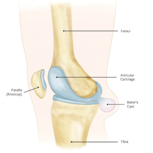 Киста бейкера под коленом. Киста коленного сустава Бейкера 25мм.. Киста Бейкера психосоматика. Киста Беккера анатомия. Киста Бейкера коленного сустава Размеры.