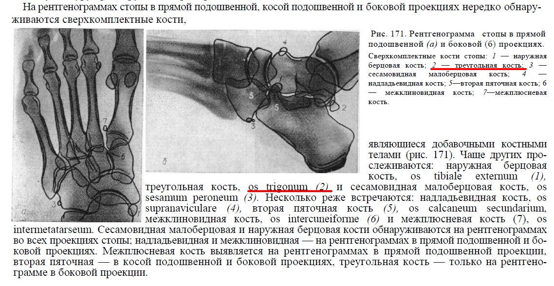 Рентген стопы в двух проекциях фото с описанием