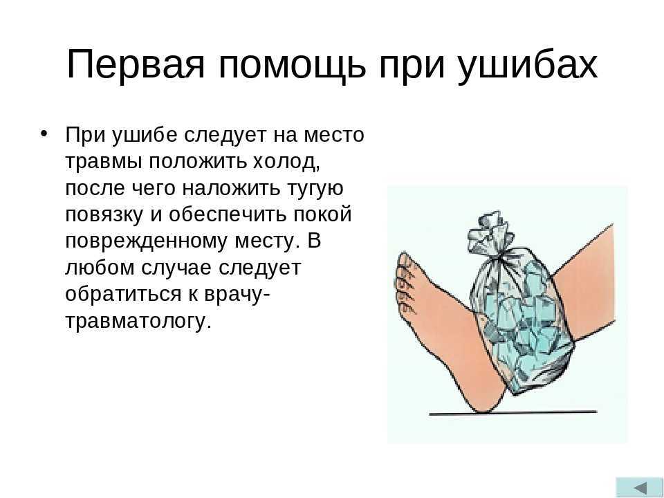 Что делать при сильном ушибе ноги. Оказание первой помощи при ушибах. Оказание первой помощи при ушибах кратко. Оказание первой медицинской помощи при ушибах ссадинах. Оказание первой помощи при ушибах кратко важное.