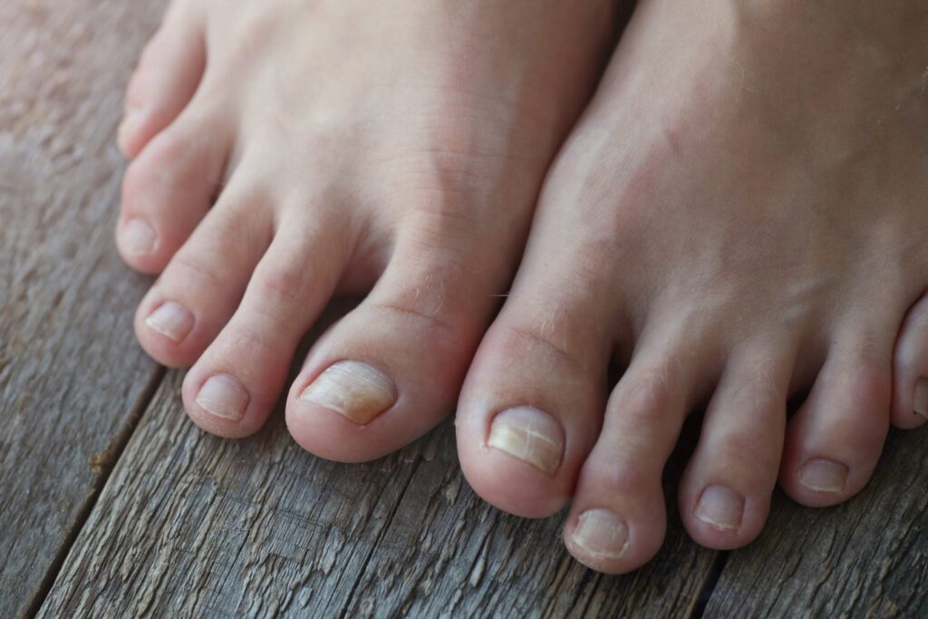 Ногти на ногах коричневого цвета фото и названия