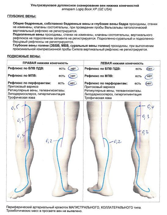 Узи нижних конечностей изранов. Показатели УЗИ вен нижних конечностей норма. Расшифровка УЗИ артерий нижних конечностей. УЗИ вен нижних конечностей протокол нормы. УЗИ артерий нижних конечностей норма показателей.
