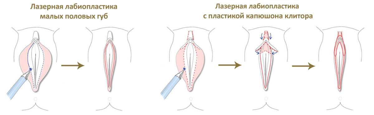 Половые Губы Внутри Фото