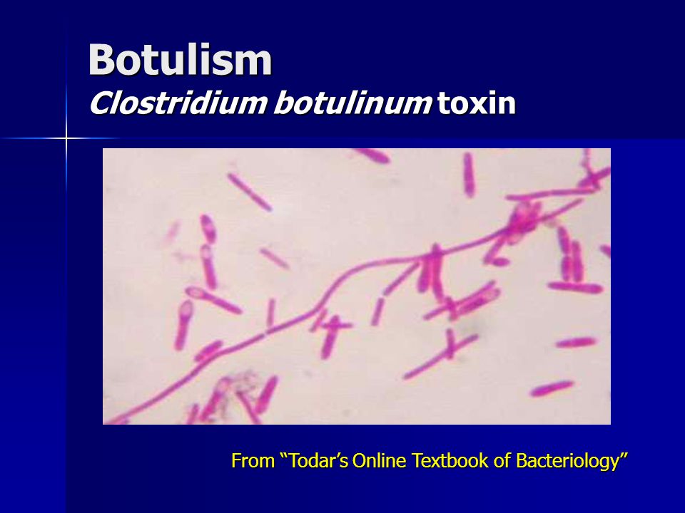 Определение токсинов а и в clostridium. Clostridium botulinum микроскоп. Клостридии ботулинум Токсин. Clostridium botulinum отношение к кислороду. Антибиотики против Clostridium perfringens.