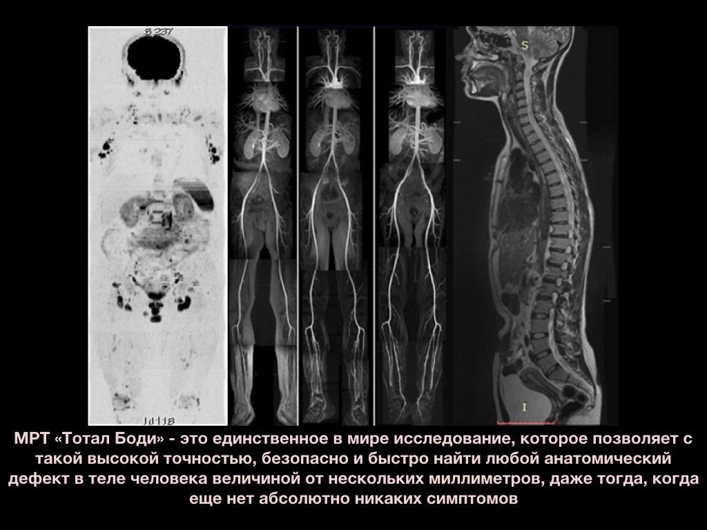 Мрт всего организма