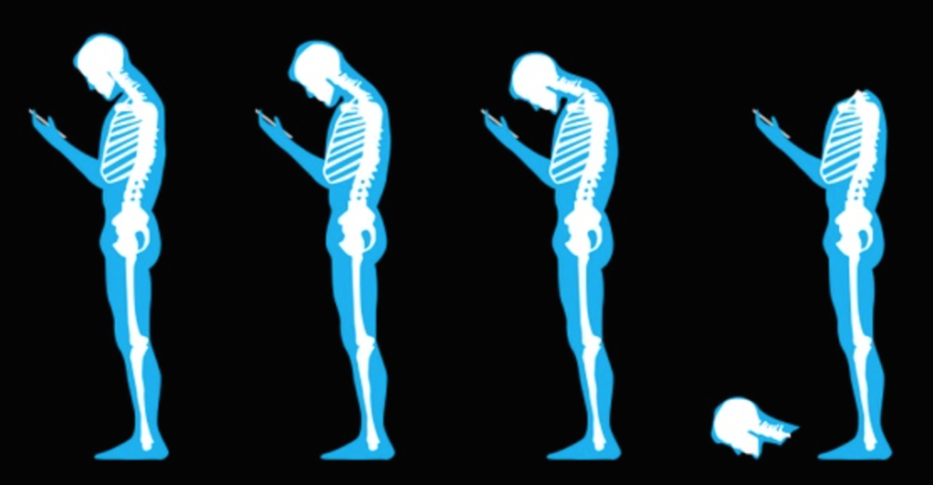 Осанка и мозг. Осанка. Опорно двигательный аппарат осанка. Искривление позвоночника от телефона. Изменение осанки человека.
