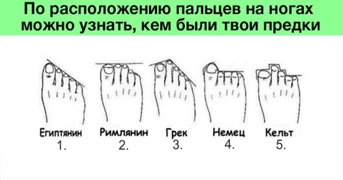Какие бывают пальцы ног. Тип человека по пальцам ног. Типы стопы по длине пальцев. Норма расположения пальцев на ногах. Форма расположения пальцев на ногах.