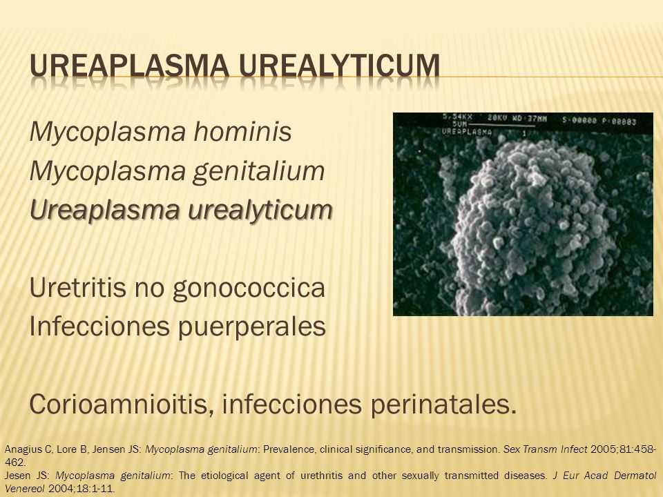 Ureaplasma. Микоплазма уреалитикум.