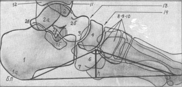 Боковая проекция стопы рентген фото