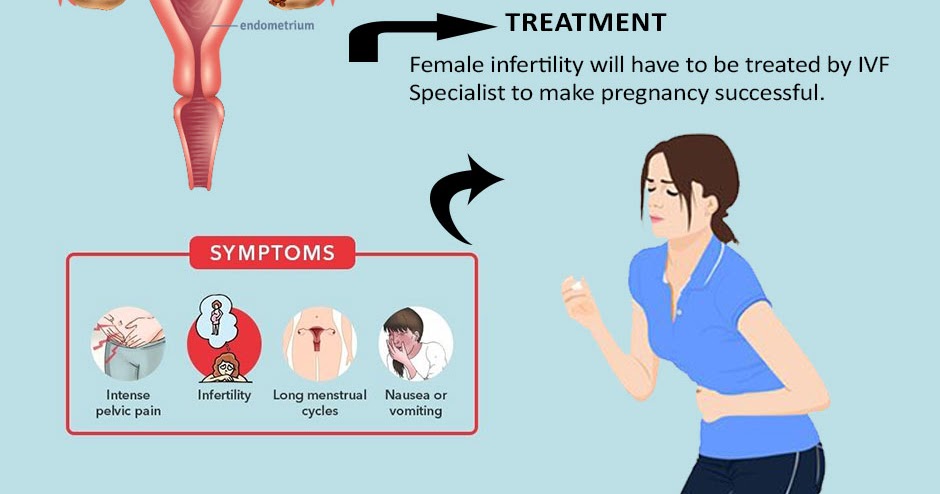Endometriosis tratamiento hormonal