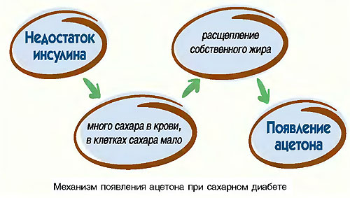 Причины диабетической комы