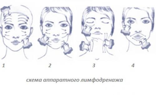 Микротоки схема проведения процедуры