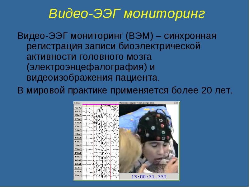 Ээг мониторинг сна. ЭЭГ ночной мониторинг ребенку. Видео ЭЭГ мониторинг. ЭЭГ дневной мониторинг. Ночной ЭЭГ видеомониторинг.