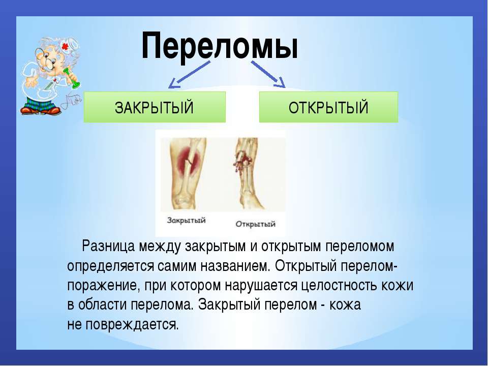 Открытый и закрытый перелом. Открытые и закрытые переломы. Открытый и закрытый перелом раница. Различия открытого и закрытого перелома.