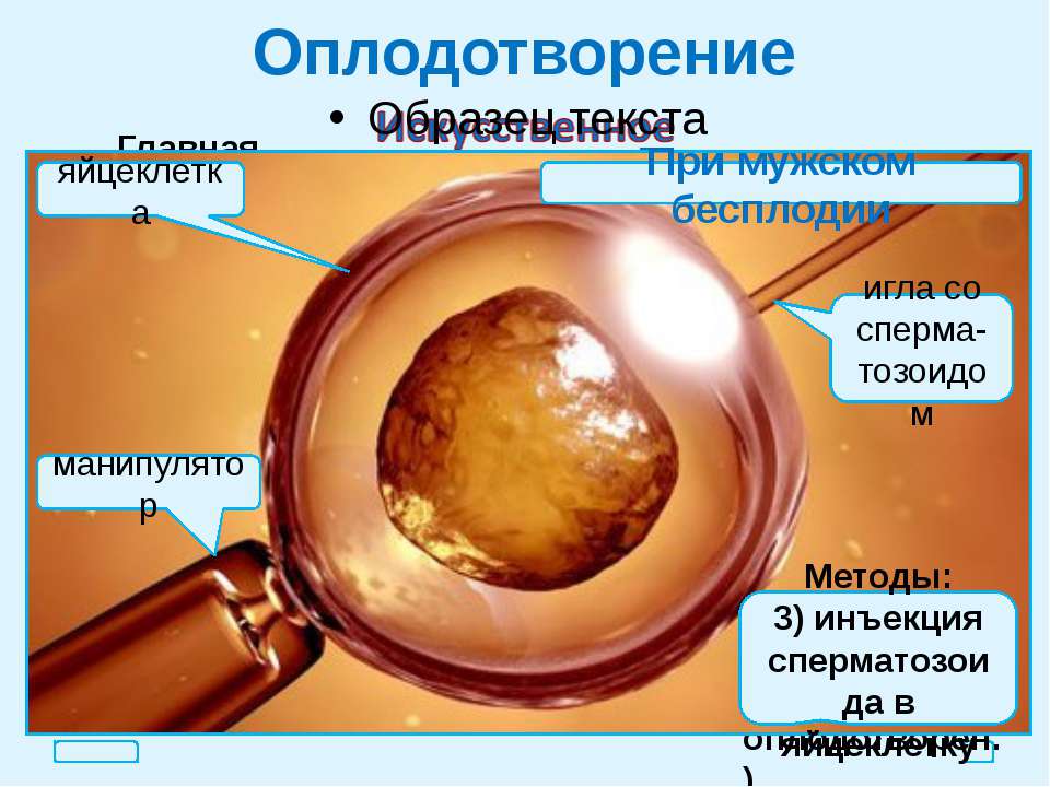 Экстракорпоральное оплодотворение презентация