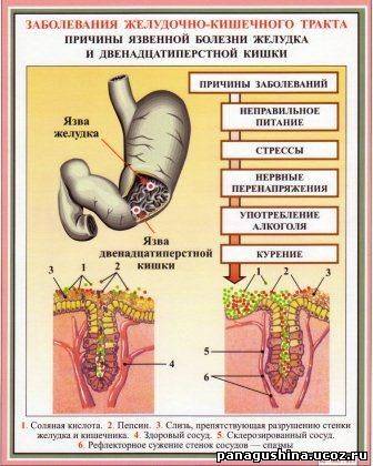 Желудочные заболевания. Памятка заболевания ЖКТ. Памятка при заболеваниях ЖКТ. Профилактика заболеваний ЖКТ. Профилактика заболеваний органов ЖКТ.