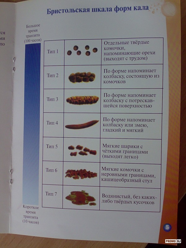 Бристольская шкала кала. Тип 5 кала по Бристольской шкале. Бристольская шкала формы кала. Бристольская шкала кала норма. Форма стула по Бристольской шкале.