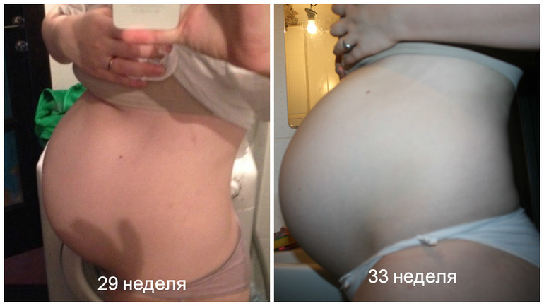 33 недели назад. Формы живота в 31 неделю. Форма живота на 32 неделе. 32-33 Недели беременности.