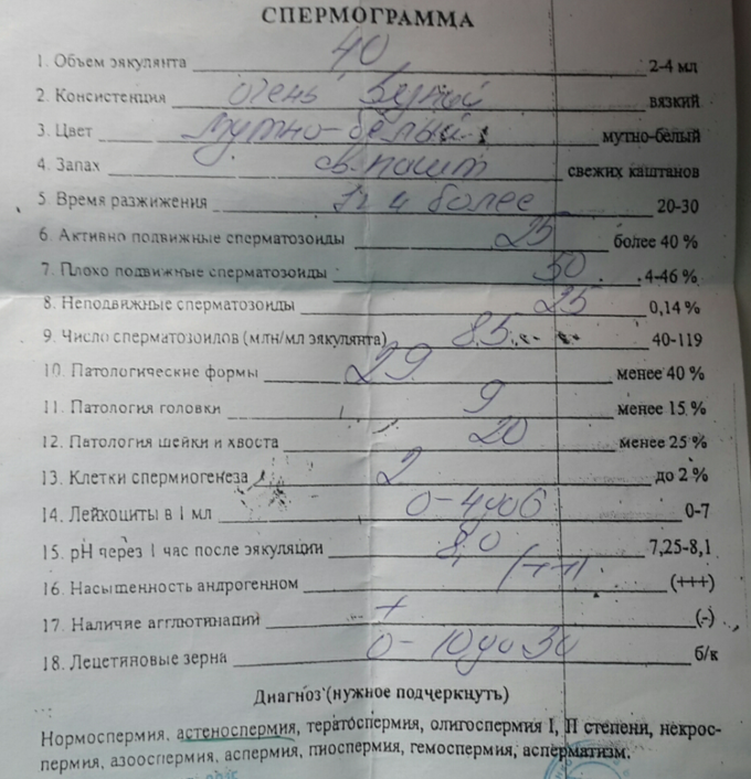 Сдача спермограммы подготовка перед анализами. Спермограмма как сдавать. Как сдают анализ на спермограмму. Спермограмма емкость. Спермограмма лаборатория.