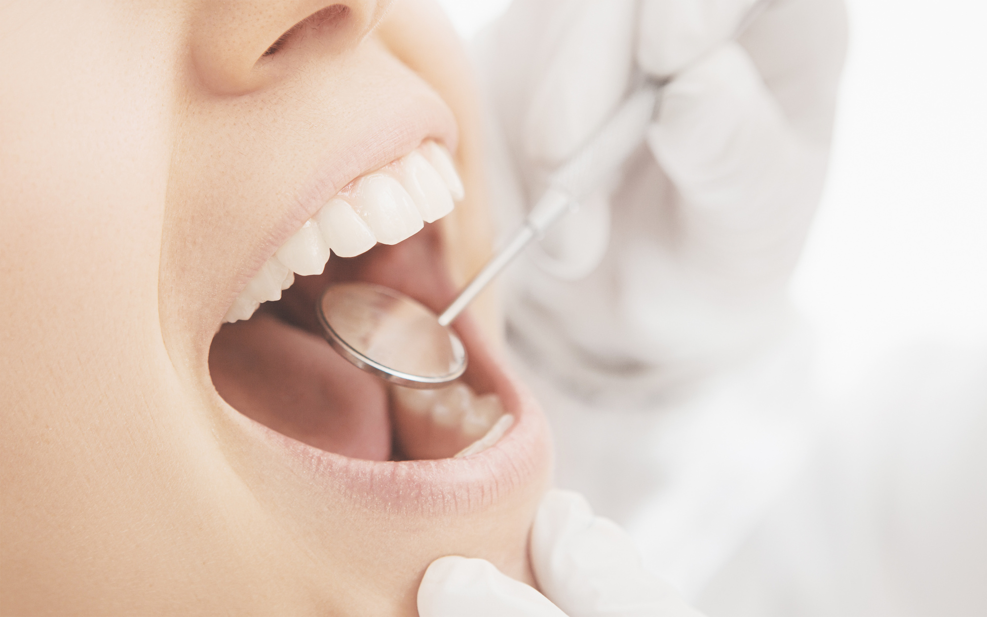 Реминерализующая терапия в стоматологии флюороз