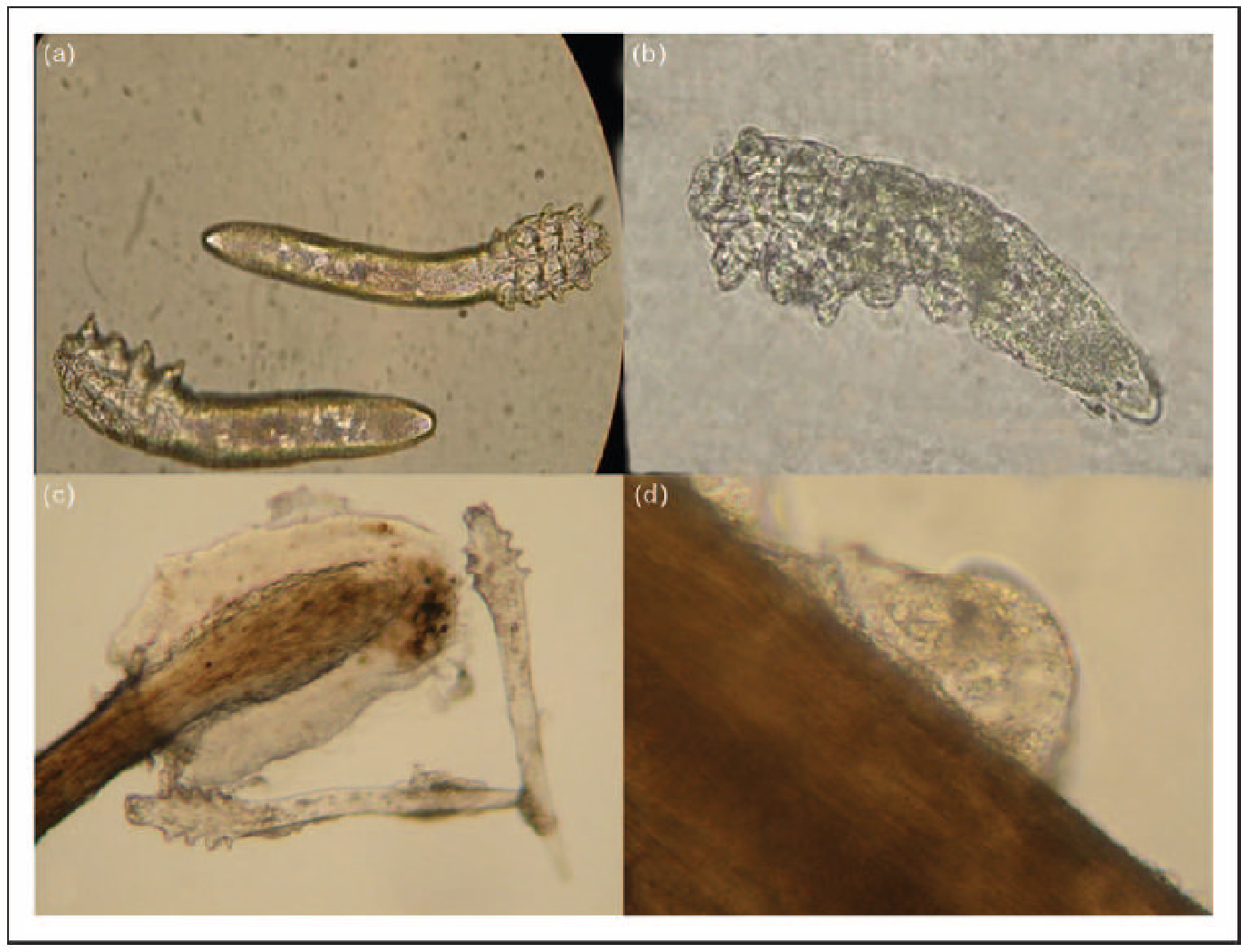 Demodex. Клещ демодекс фолликулорум. Ресничные клещи демодекс.