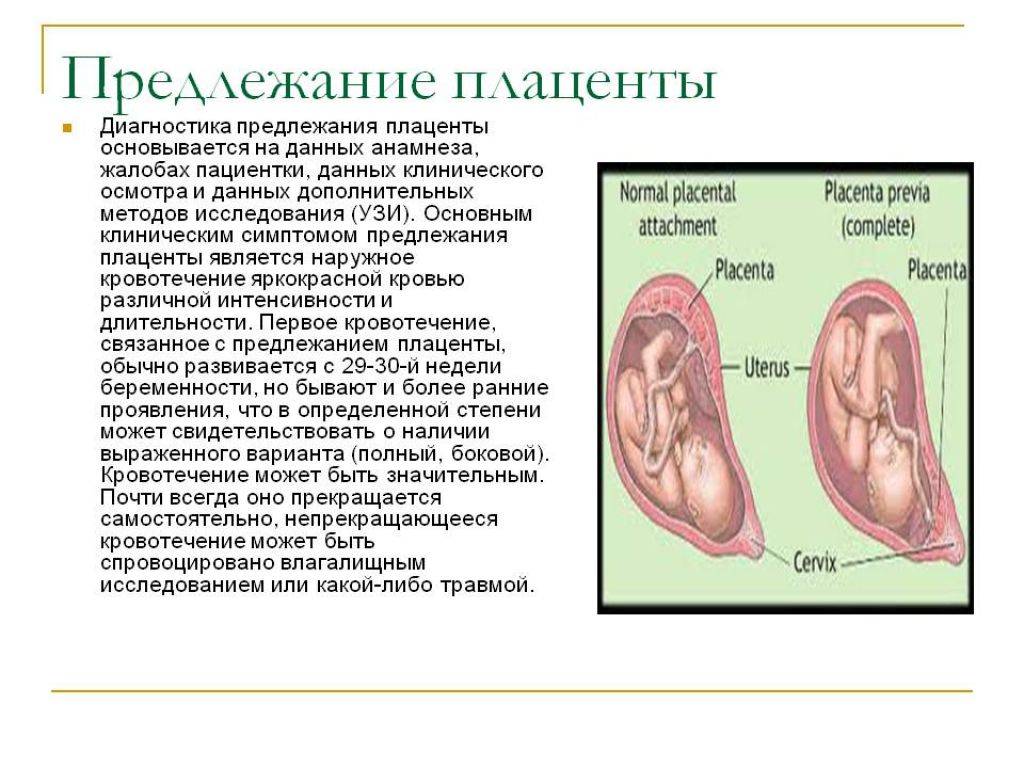 Низкая плацентация. Жалобы при предлежании плаценты. Основной симптом предлежания плаценты. Основные симптомы при предлежании плаценты.. Основным клиническим симптомом предлежания плаценты является.