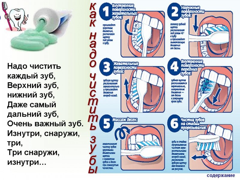 Чистят причины. Схема чистки зубов. Схема правильной чистки зубов. Алгоритм чистки зубов для детей. Плакат о правильной чистке зубов.