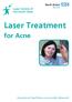 Laser Treatment for Acne