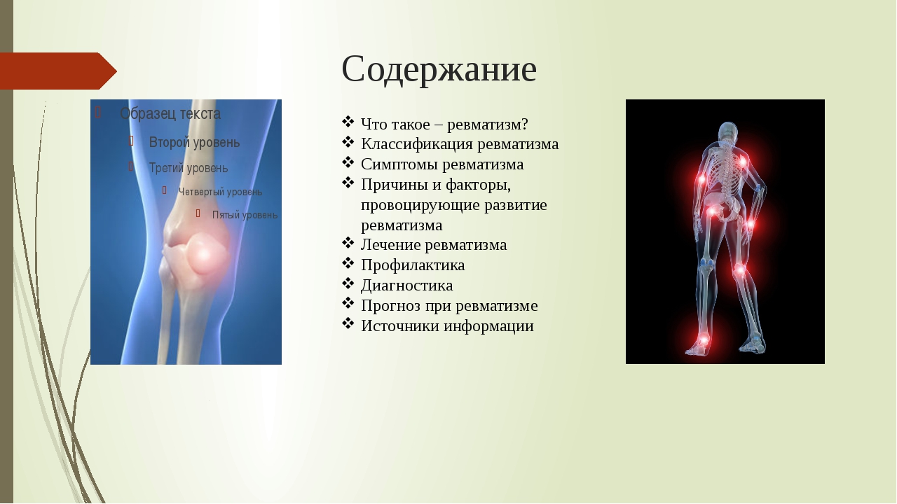 Ревматизм. Ревматизм симптомы у взрослых. Ревматизм сердца симптомы.