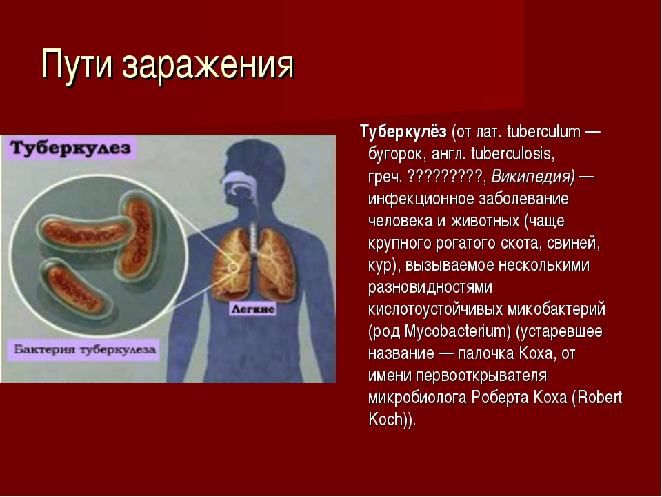 Туберкулез слайд. Туберкулез презентация. Презентация на тему туберкулез. Туберкулез презентация по биологии.