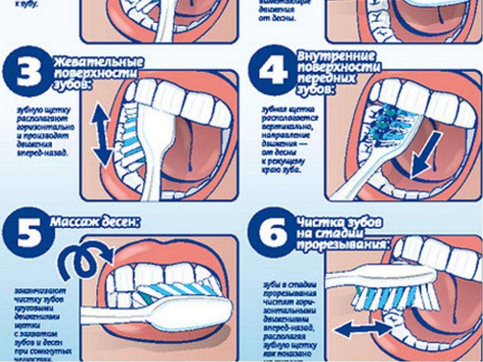 Зубы нужно чистить до или после завтрака. Схема правильной чистки зубов. Правельна схема чистки зубов. Стандартный метод чистки зубов схема. Схема чистки зубов электрической щеткой.