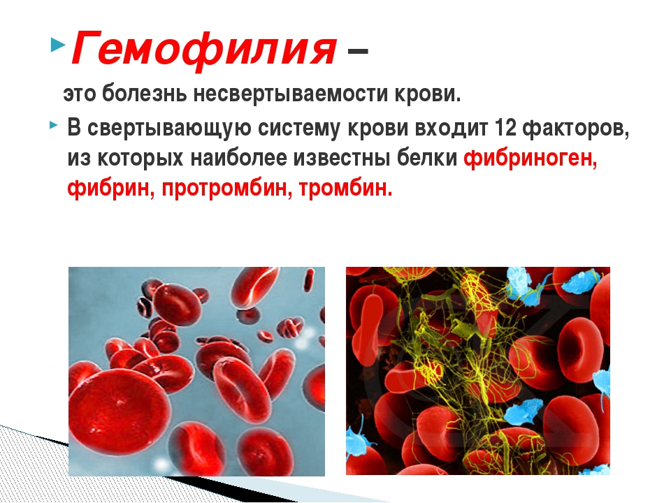 Инфекция в крови у ребенка что это. Болезни системы крови. Гемофилия и заболевание крови. Болезнь несвёртываемости крови. Заболевания свертывания крови.