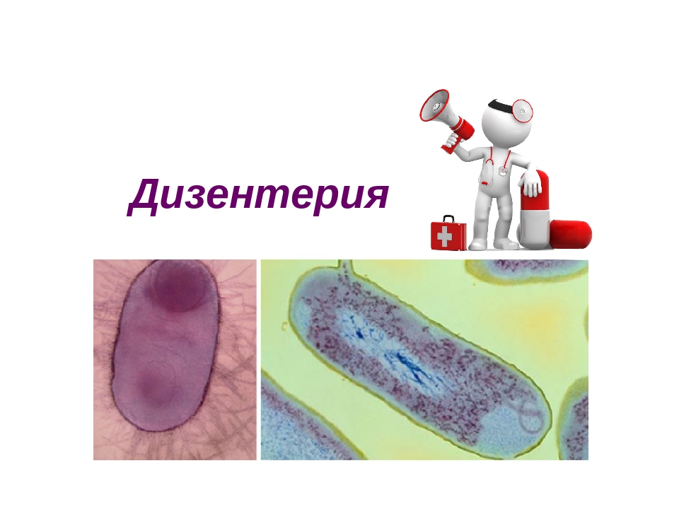 Заболевание дизентерия. Дизентерия. Вирусные дизентерия. Дизентерия это вирус или бактерия. Микробы дизентерии поражают.