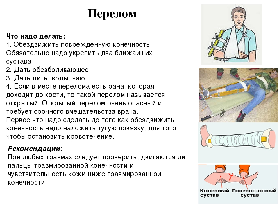 Переломы костей доврачебная помощь. Оказание помощи при открытых переломах. Действия при переломе конечностей. Оказание первой помощи при переломах конечностей. При открытых переломах конечностей необходимо:.