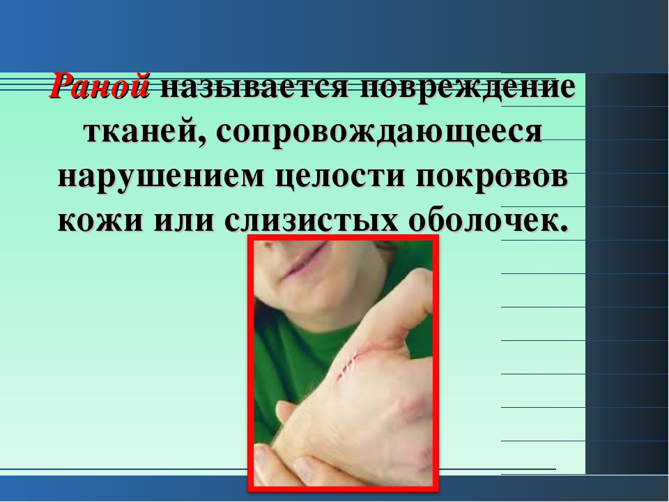 Обж 11 презентации. Раной называется повреждение тканей сопровождающееся.