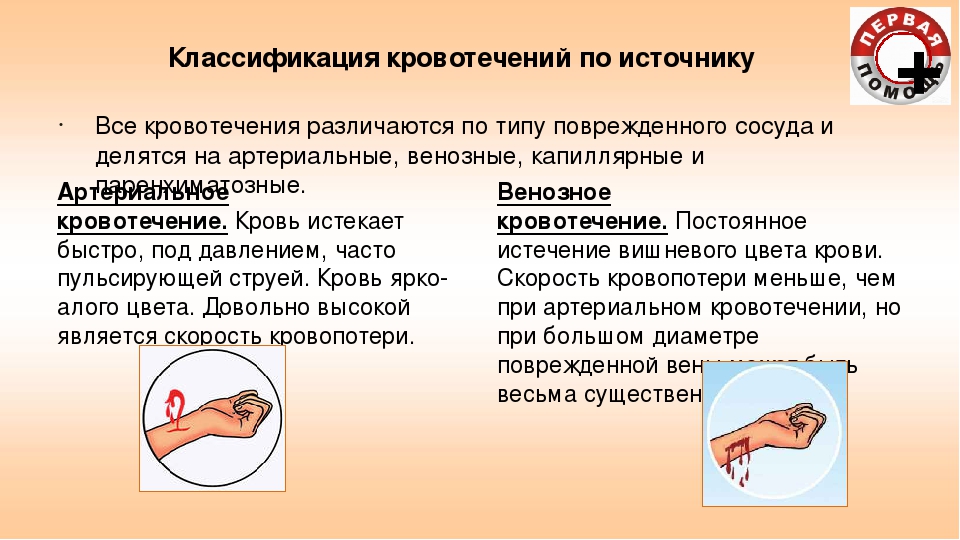 Разница между артериальной и венозной. Артериальное и венозное кровотечение. Кровотечения венозное от артериального кровотечения. Артериальное венозное и капиллярное кровотечение. Венозное и артериальное кровотечение разница.