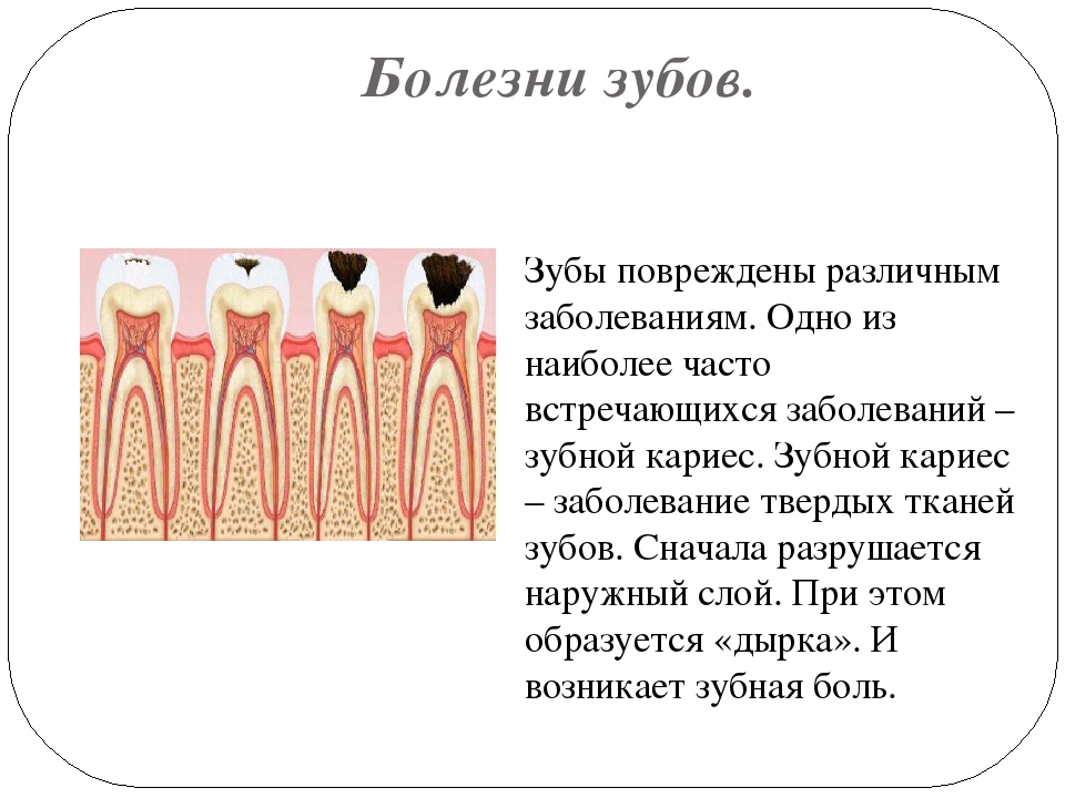 Заболевания зубов и полости. Разные заболевания зубов. Заболевания зубов схема.