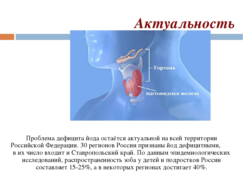 Проблема йодного дефицита проект