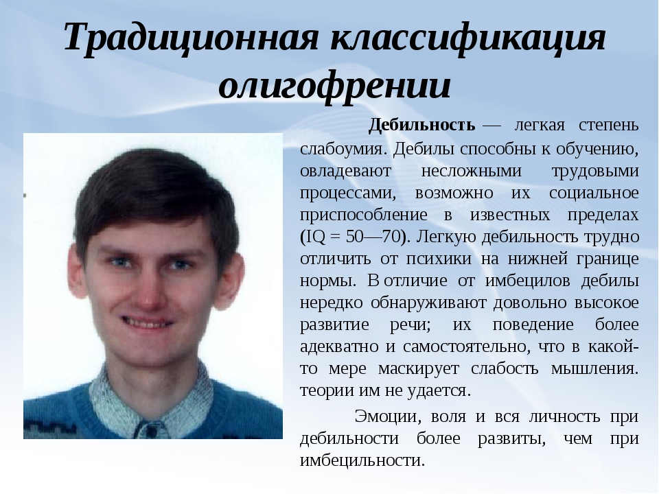 Легкая отсталость. Умственная отсталость дебилизм. Легкая степень олигофрении. Олигофрения в степени дебильности. Дебильность это степень умственной отсталости.